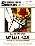 Photo : My Left Foot