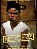 Photo : Métastases