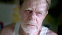 image de Shameless (US) - saison 4 Teaser (2) VO