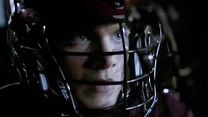 image de Teen Wolf - saison 3 - épisode 5 Teaser VO