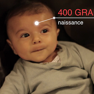 Photo Le Cerveau des enfants