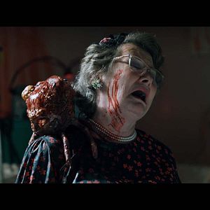 Photo Cyst