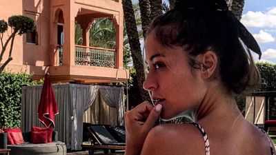 image de la news Anaïs Camizuli (Les Cinquante) "défigurée", elle raconte ce qu'il s'est passé